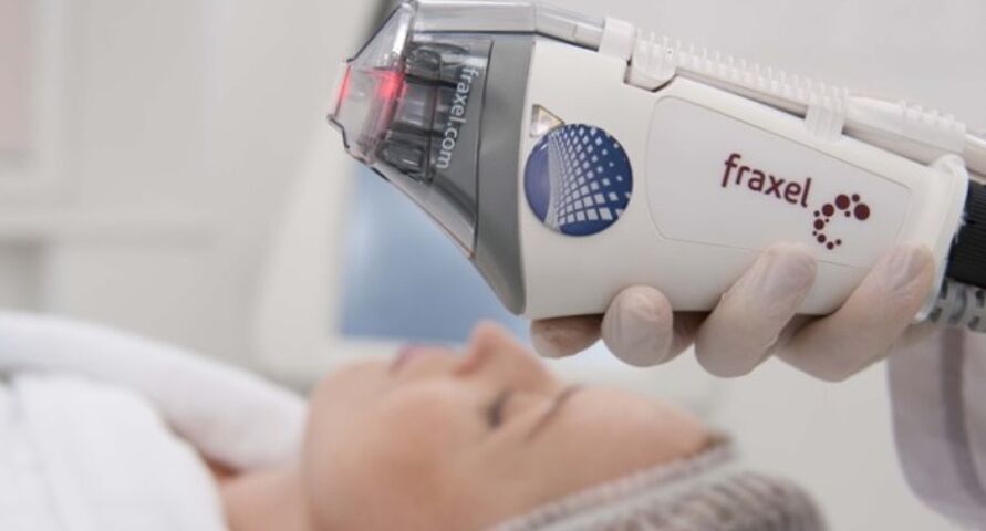 fractional skin resurfacing machine