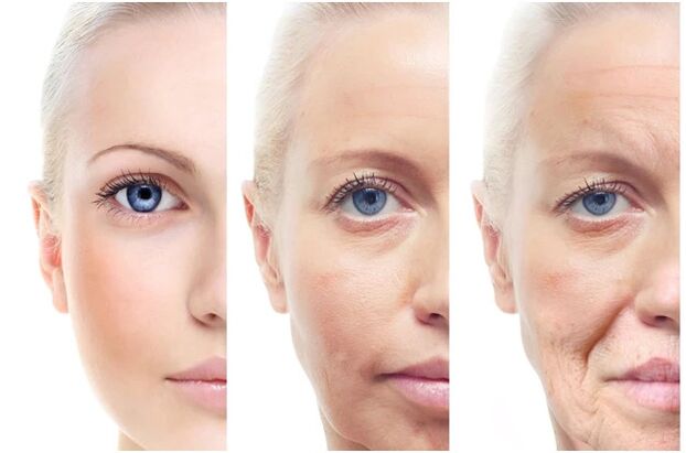 Laser removal of age -related facial changes