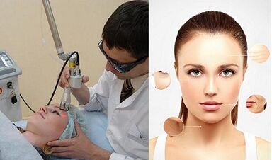 How is laser skin rejuvenation performed