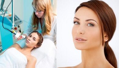 The essence of the laser skin rejuvenation procedure